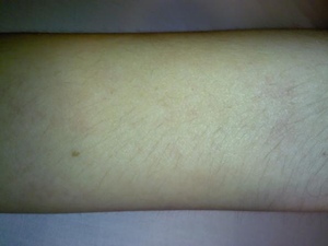 �P�m���̌��k